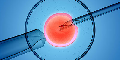 Fertility Treatments