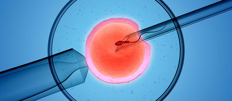 Fertility Treatments